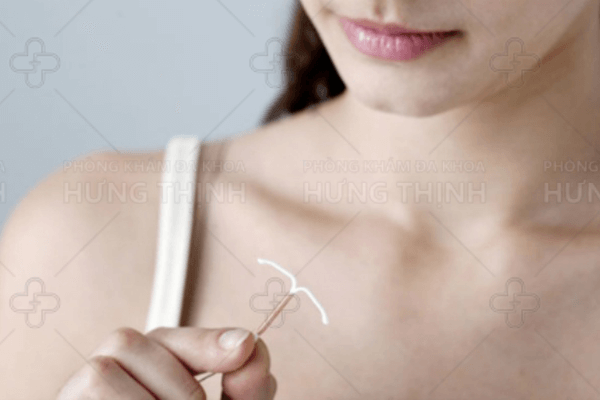 Đặt vòng tránh thai sau sinh 